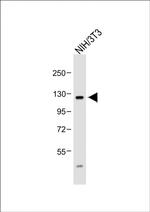 FGFR4 Antibody in Western Blot (WB)