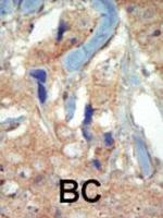 FLT3 Polyclonal Antibody