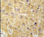 ILK Antibody in Immunohistochemistry (Paraffin) (IHC (P))