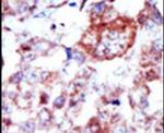 ILK Antibody in Immunohistochemistry (Paraffin) (IHC (P))