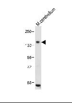 c-Kit Antibody in Western Blot (WB)
