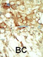 RET Polyclonal Antibody
