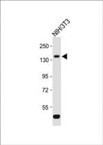 ROR1 Polyclonal Antibody