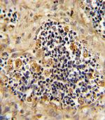 ROR2 Polyclonal Antibody