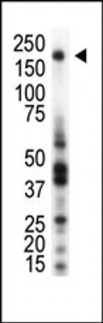 RON Polyclonal Antibody