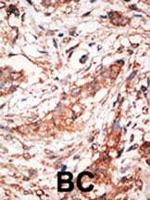 DOK4 Antibody in Immunohistochemistry (Paraffin) (IHC (P))