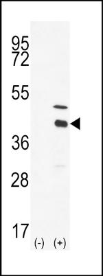 DOK4 Antibody in Western Blot (WB)
