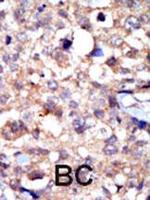 c-Abl Polyclonal Antibody