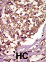 ETK Polyclonal Antibody