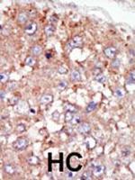 BRK Polyclonal Antibody