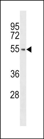 BRK Antibody in Western Blot (WB)