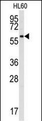 SRMS Antibody in Western Blot (WB)