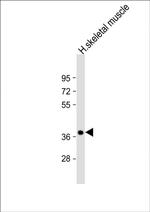 TRIB1 Polyclonal Antibody