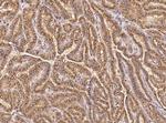GM130 Polyclonal Antibody