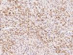 ADAT3 Polyclonal Antibody