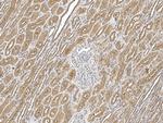 SLC52A1 Polyclonal Antibody