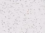 HOXA10 Antibody in Immunohistochemistry (Paraffin) (IHC (P))