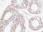 HOXA10 Polyclonal Antibody