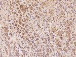 Clathrin Heavy Chain Polyclonal Antibody