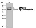 LMOD2 Antibody in Immunoprecipitation (IP)