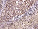 Clathrin Heavy Chain Polyclonal Antibody