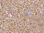 Clathrin Heavy Chain Antibody in Immunohistochemistry (Paraffin) (IHC (P))