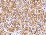 NUDT5 Antibody in Immunohistochemistry (Paraffin) (IHC (P))