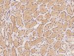ATP6V0C Polyclonal Antibody