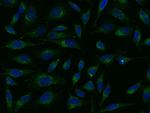 VWF Polyclonal Antibody