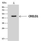 CRELD1 Antibody in Immunoprecipitation (IP)
