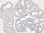 SMPDL3A Antibody in Immunohistochemistry (Paraffin) (IHC (P))