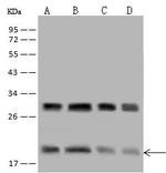 eIF5A2 Polyclonal Antibody