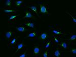 ARF3 Polyclonal Antibody
