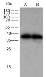 ADPRH Polyclonal Antibody