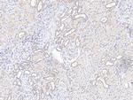 KBP Polyclonal Antibody