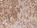 LRRC19 Polyclonal Antibody