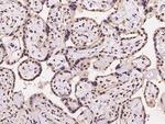 NMNAT1 Polyclonal Antibody