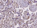 Clathrin Light Chain A Antibody in Immunohistochemistry (Paraffin) (IHC (P))