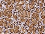 SCLY Polyclonal Antibody