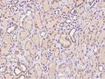 CTR2 Polyclonal Antibody