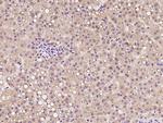 CTR2 Antibody in Immunohistochemistry (Paraffin) (IHC (P))