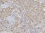 PSMD4 Polyclonal Antibody