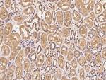 PPM1B Polyclonal Antibody