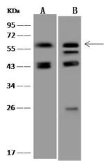 PPM1B Antibody in Western Blot (WB)
