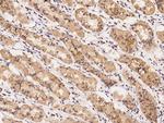 UROS Polyclonal Antibody