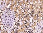 SNX31 Antibody in Immunohistochemistry (Paraffin) (IHC (P))