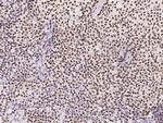 RUNX3 Polyclonal Antibody