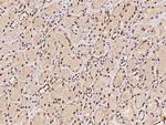 CTDSP2 Antibody in Immunohistochemistry (Paraffin) (IHC (P))