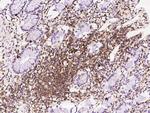 PPP1R18 Antibody in Immunohistochemistry (Paraffin) (IHC (P))
