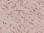 C11orf58 Polyclonal Antibody